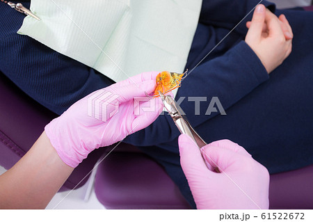 The dentist adjusts the anatomical orthodontic plate of orange acrylic and metal in the form of a jaw with a special tool. Close-up The dentist adjusts the anatomical orthodontic plate of orange acrylic and metal in the form of a jaw with a special tool. Close-up 61522672