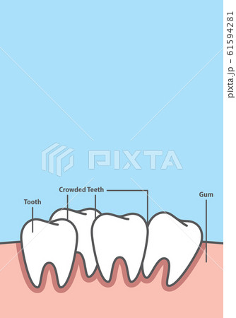 Blank banner Crowding tooth frame cartoon style Blank banner Crowding tooth frame cartoon style 61594281