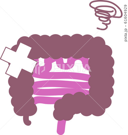 シンプルな不健康な腸のイラスト 内臓 / 消化器 シンプルな不健康な腸のイラスト 内臓 / 消化器 61604929