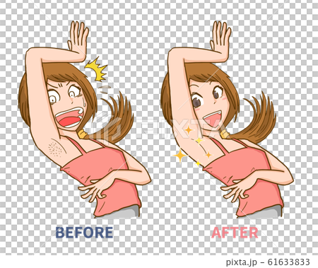 Women's armpits, wasted hair, hair loss, worries, impatience, before and after 61633833