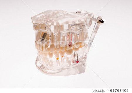 Transparent dentures jaw layout on a white Transparent dentures jaw layout on a white 61763405