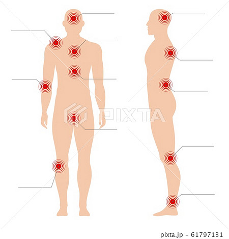 Man body with pain points. Circle painful red spot point on human silhouette vector medical abstract illustration 61797131
