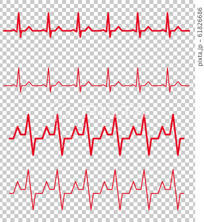 心電圖節律變化集 61826686