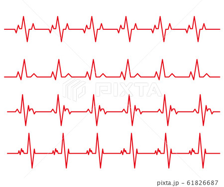 心電図のリズム バリエーションセットのイラスト素材