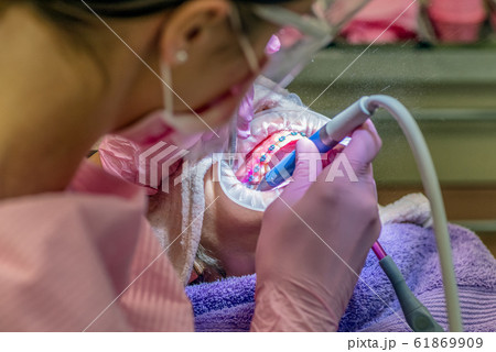 Young kid with braces and cheek retractor. Dentist cleaning dental plaque Young kid with braces and cheek retractor. Dentist cleaning dental plaque 61869909