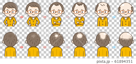 脫髮的進展 61894351