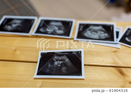 妊娠 エコー写真 妊娠 エコー写真 61904316