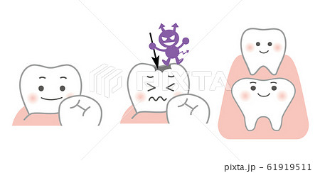 歯 歯 61919511