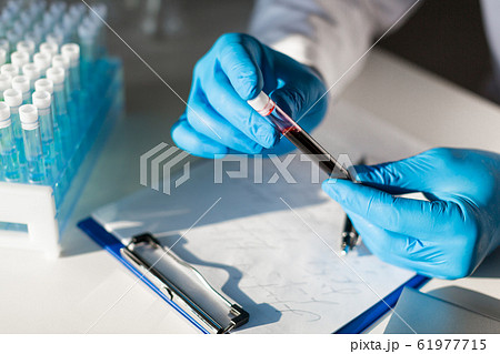 Close up photo of blood sample in researcher's hands. 61977715