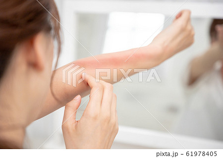 日焼け 跡 女性 日焼け 跡 女性 61978405