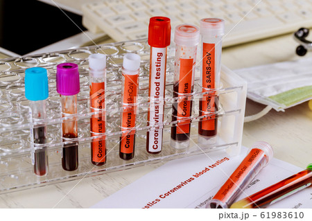 Test blood sample in collection tube with Test blood sample in collection tube with 61983610