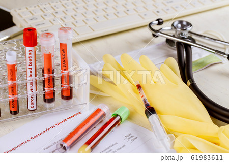 Vacuum tubes for collecting and blood samples with Vacuum tubes for collecting and blood samples with 61983611