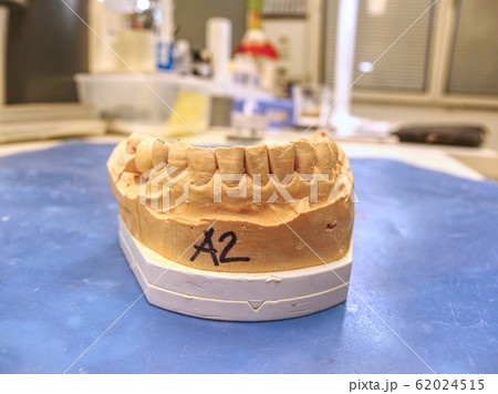 Metal-ceramic dental crown is tried on an gypsum 62024515