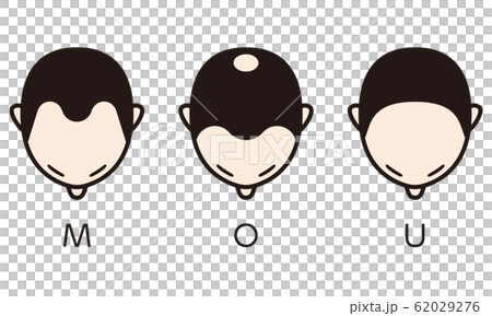 Hamilton Norwood Classification Bald Hamilton Norwood Classification Bald 62029276