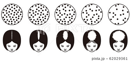 ルードヴィヒの分類 　ハゲ 62029361