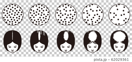 ルードヴィヒの分類 　ハゲ 62029361