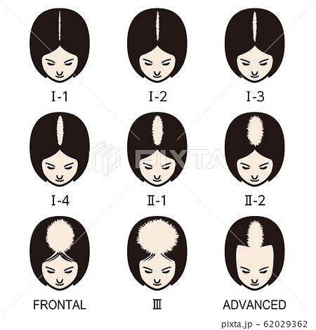 ルードヴィヒの分類 　ハゲ 62029362