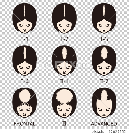 ルードヴィヒの分類 　ハゲ 62029362