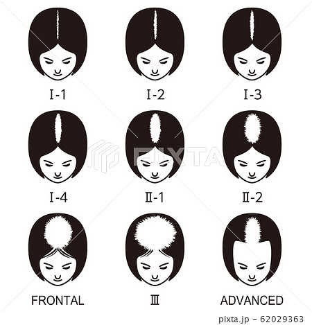 ルードヴィヒの分類 ハゲのイラスト素材