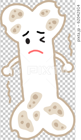 骨粗鬆症　弱い骨 62042914