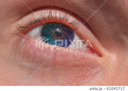 Aperture of the eye Aperture of the eye 62045717