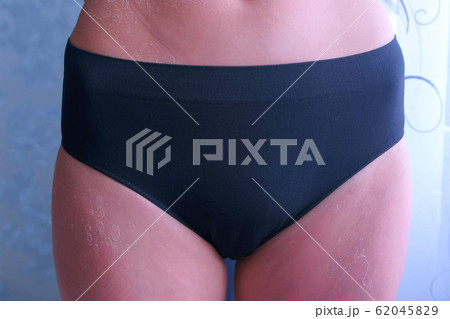 Woman with peeling skin from UV sunburn on legs and tummy, closeup. 62045829