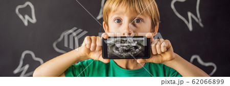 The boy shows his X-ray image of his teeth with an abnormally strange extra tooth. Children's The boy shows his X-ray image of his teeth with an abnormally strange extra tooth. Children's 62066899