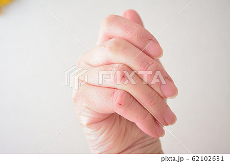 女性の乾燥した手 女性の乾燥した手 62102631