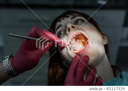 Close up portrait of young female patient with open mouth having professional dental treatment, and hands of doctor wearing red rubber gloves, holding dental mirror 62117324