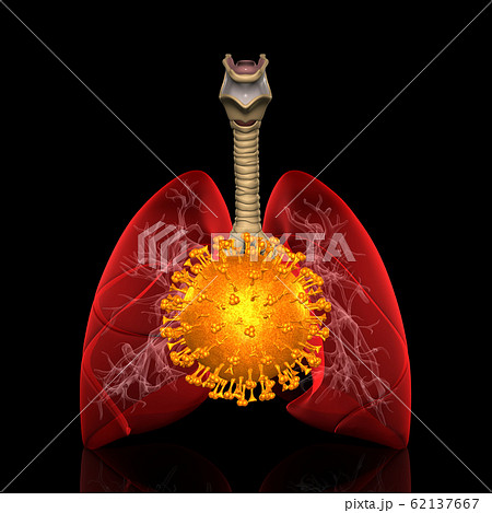 コロナウイルス（COVID-19）肺炎 62137667