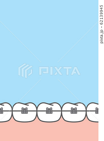Blank banner metal braces teeth illustration 62139945