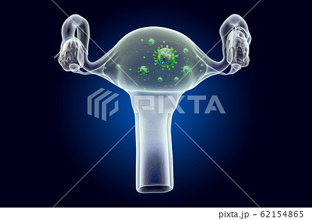 Uterus with virus, ghost light effect 62154865
