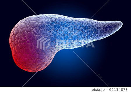 Pain in Pancreatic concept. Ghost light effect 62154873