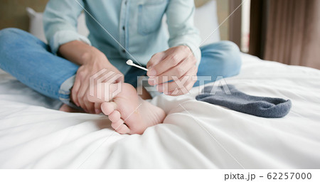 applying cream for athletes foot applying cream for athletes foot 62257000