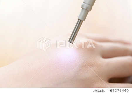 肌測定イメージ 62275440