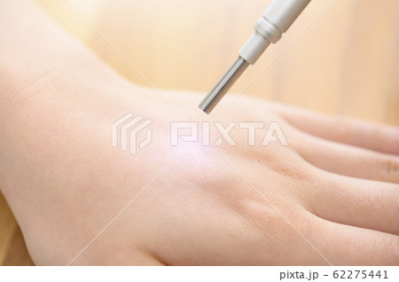 肌測定イメージ 62275441