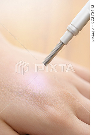 肌測定イメージ 62275442