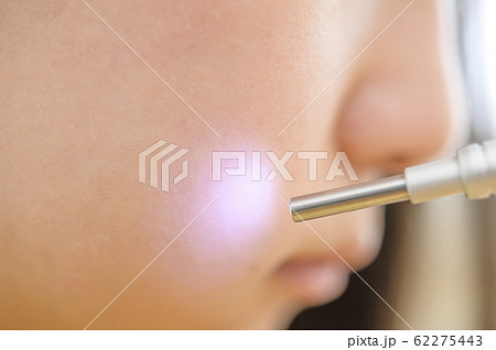 肌測定イメージ 62275443