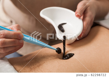 the doctor puts a leech tweezers on a stomach of the person the doctor puts a leech tweezers on a stomach of the person 62298722