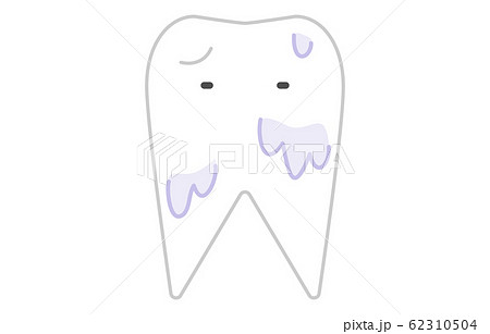 脱灰、口内のpH値が酸性に近づいて溶ける歯のイメージ 62310504