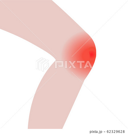 Knee pain 62329628