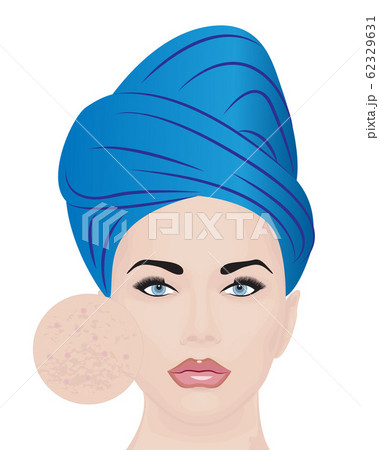 Vector illustration of a girl having skin problems 62329631