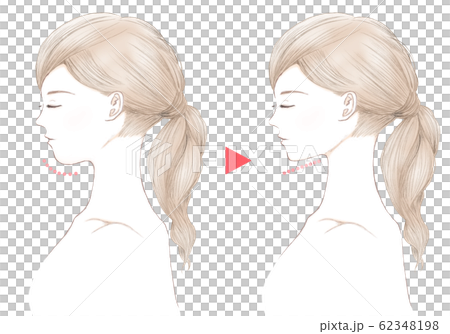 Young woman with closed eyes-double chin-before and after 62348198