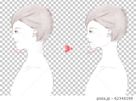 Senior Woman with Closed Eyes-Double Chin-Before After 62348199