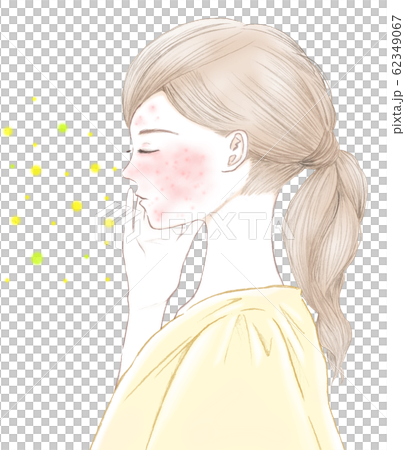 花粉症による肌荒れ　赤い湿疹　アレルギー性敏感肌 62349067