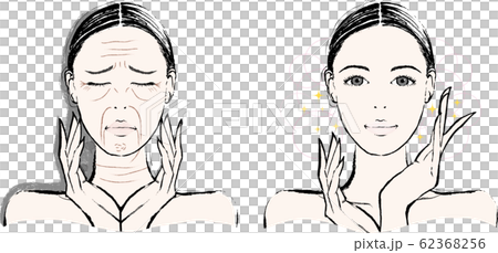 Woman wrinkle before after 62368256