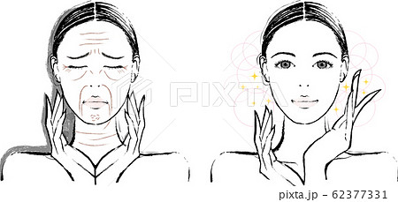 女性　シワ　ビフォーアフター 62377331