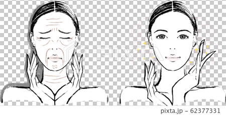 Woman wrinkle before after 62377331