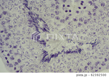 精巣切片 顕微鏡写真 精巣切片 顕微鏡写真 62392500