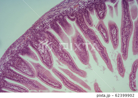 小腸切片 顕微鏡写真 小腸切片 顕微鏡写真 62399902